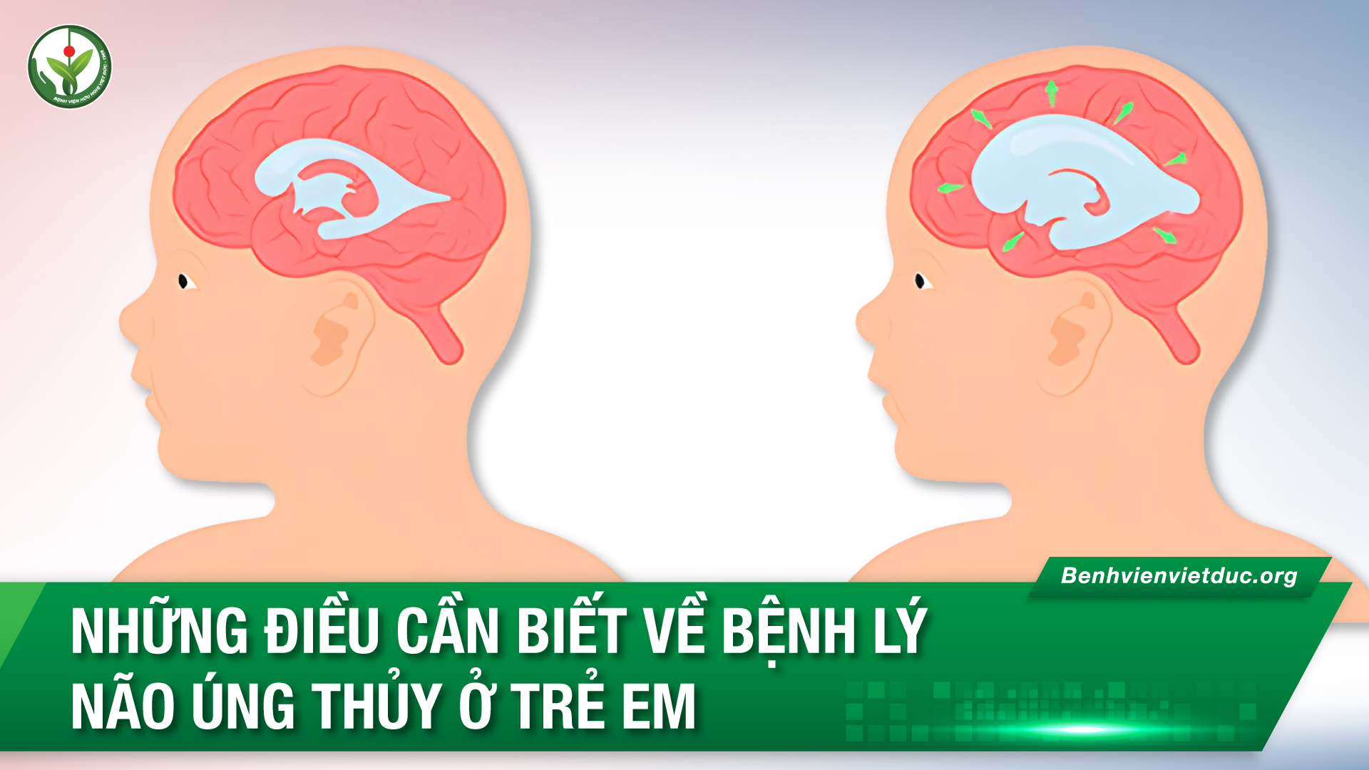 05.01.2024-YHTT-Nao-ung-thuy-tre-em.jpg
