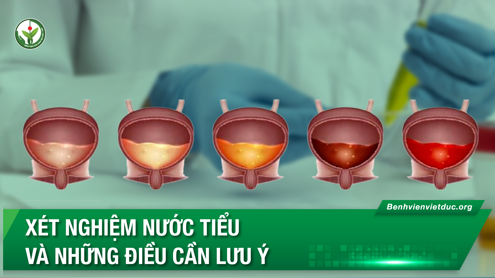 30.05.2024-YHTT-XN-Nuoc-tieu.jpg