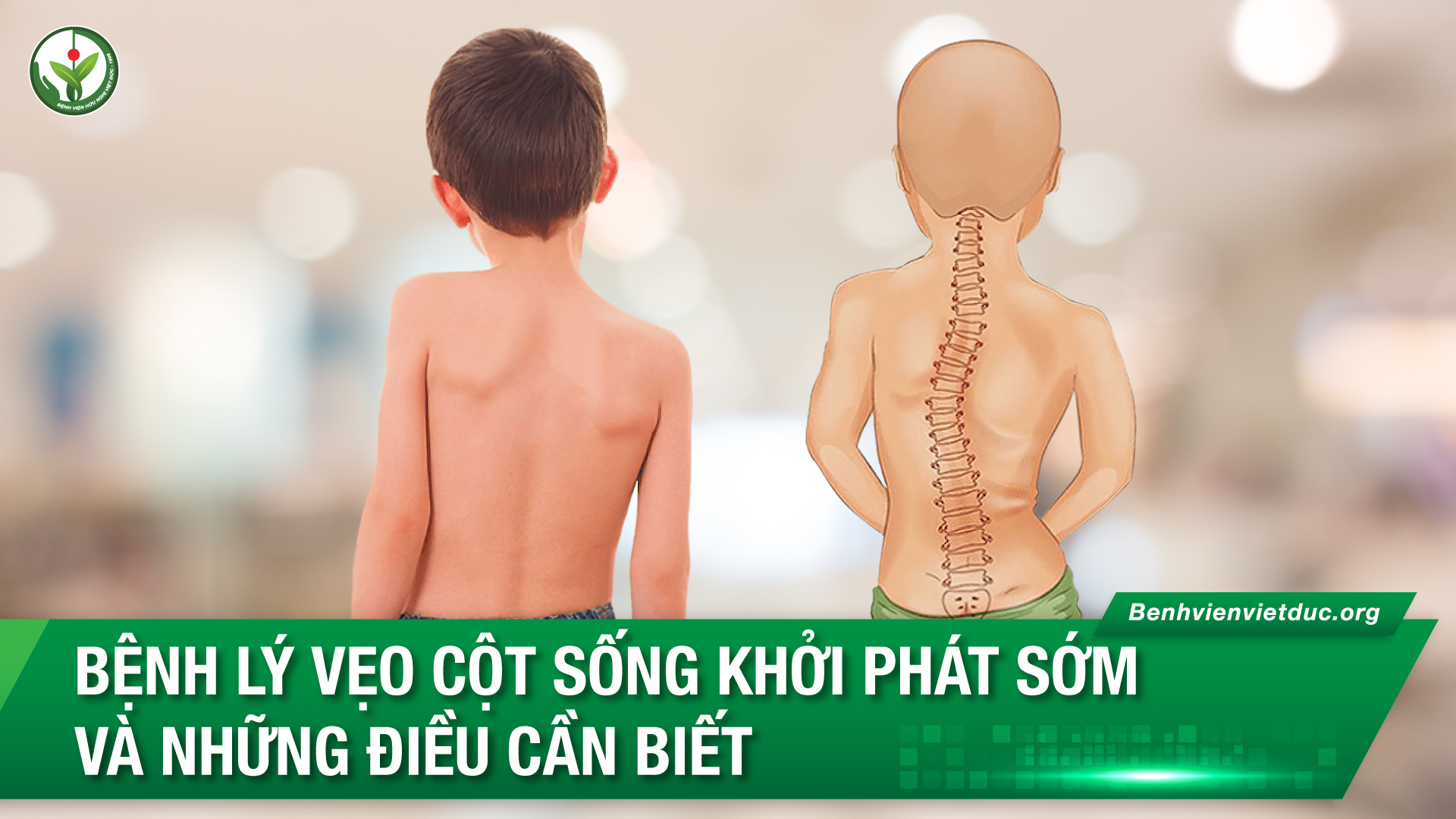 09.11.2023-YHTT-Veo-Cot-song-can-biet.jpg